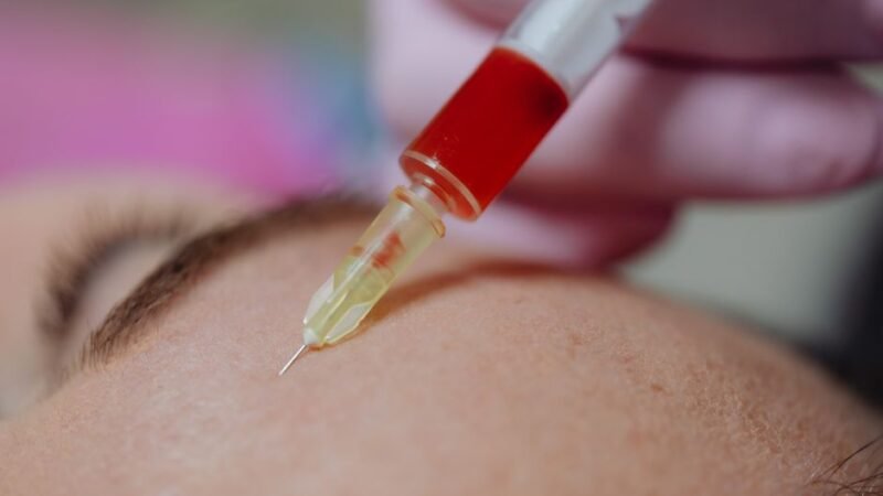 PDRN Therapy Benefits: The Next Breakthrough in Skin & Tissue Regeneration for 2025