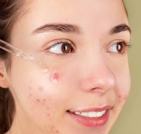 Skin Cycling: The Dermatologist-Approved Routine for Clearer Skin