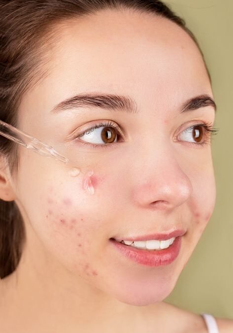 Skin Cycling: The Dermatologist-Approved Routine for Clearer Skin