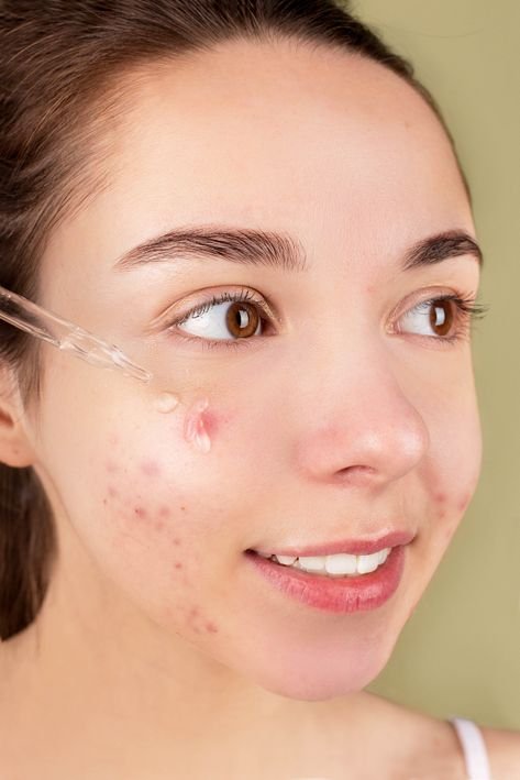 Skin Cycling: The Dermatologist-Approved Routine for Clearer Skin