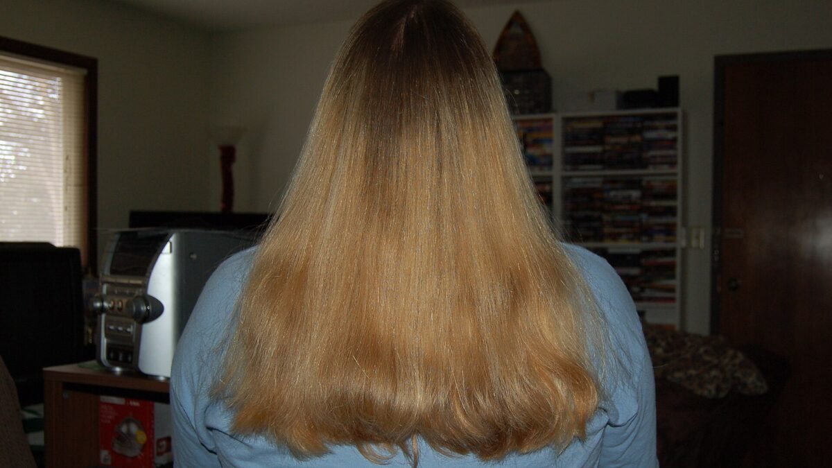Hair Thinning in Women: Causes and Evidence-Based Treatments